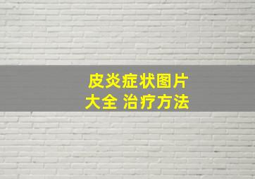 皮炎症状图片大全 治疗方法